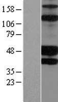 KIR2DS2 Human Over-expression Lysate