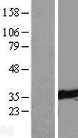 TTC33 Human Over-expression Lysate