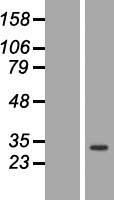 ANP32C Human Over-expression Lysate