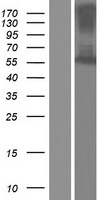 Fascin 2 (FSCN2) Human Over-expression Lysate