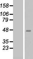 QPCT Human Over-expression Lysate