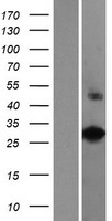 VAX2 Human Over-expression Lysate