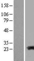 TAGLN3 Human Over-expression Lysate