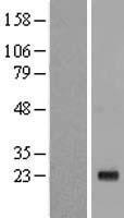 IL17C Human Over-expression Lysate