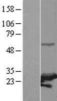 PSMC3IP Human Over-expression Lysate