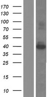 SAC3D1 Human Over-expression Lysate