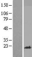 YPEL1 Human Over-expression Lysate