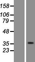 OR10H1 Human Over-expression Lysate