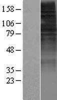 OR10H2 Human Over-expression Lysate