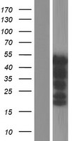 PAX8 Human Over-expression Lysate