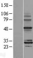 MRPS18B Human Over-expression Lysate