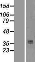 OIF (OGN) Human Over-expression Lysate