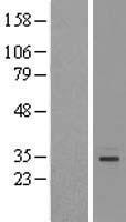 GTPBP8 Human Over-expression Lysate