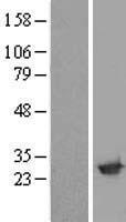 Amisyn (STXBP6) Human Over-expression Lysate
