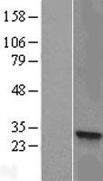 HSD17B8 Human Over-expression Lysate