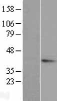 TGDS Human Over-expression Lysate