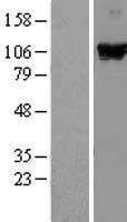 DDX58 Human Over-expression Lysate