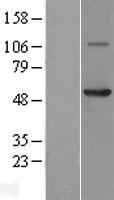 Coronin 3 (CORO1C) Human Over-expression Lysate