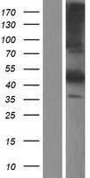 Fetuin B (FETUB) Human Over-expression Lysate