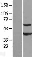 CESK1 (CCT8L2) Human Over-expression Lysate