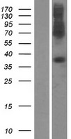SLC39A1 Human Over-expression Lysate