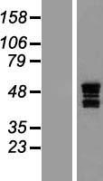 ASAHL (NAAA) Human Over-expression Lysate
