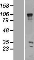 VENTX Human Over-expression Lysate