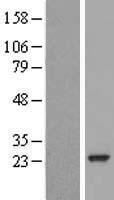 RAB30 Human Over-expression Lysate