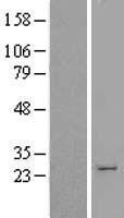 HPGDS Human Over-expression Lysate
