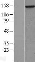 MYBBP1A Human Over-expression Lysate