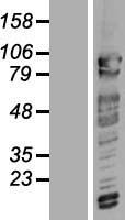 CCR4 NOT transcription complex subunit 3 (CNOT3) Human Over-expression Lysate