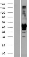 KIR2DS1 Human Over-expression Lysate