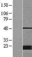 MT (MCAT) Human Over-expression Lysate