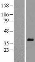 Hey L (HEYL) Human Over-expression Lysate