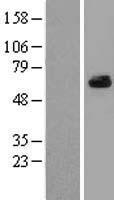 ARFGAP3 Human Over-expression Lysate