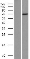 ZNF354C Human Over-expression Lysate