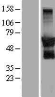 G protein regulated inducer of neurite outgrowth 2 (GPRIN2) Human Over-expression Lysate