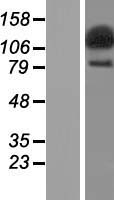 SECISBP2L Human Over-expression Lysate
