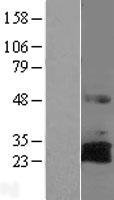 RNF144 (RNF144A) Human Over-expression Lysate