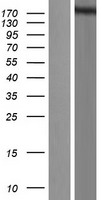 hSET1 (SETD1A) Human Over-expression Lysate