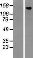 TBC1D4 Human Over-expression Lysate
