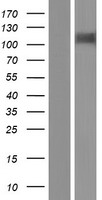 Hephaestin (HEPH) Human Over-expression Lysate