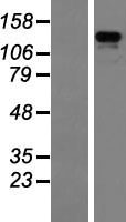 ZBED4 Human Over-expression Lysate