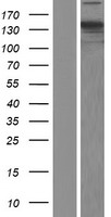 CNAP1 (NCAPD2) Human Over-expression Lysate