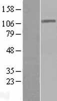 DIS3 Human Over-expression Lysate