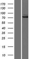 Glutaminase (GLS) Human Over-expression Lysate