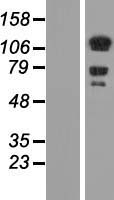 DAAM1 Human Over-expression Lysate