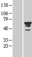 CDC2L6 (CDK19) Human Over-expression Lysate