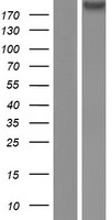 SZT2 Human Over-expression Lysate