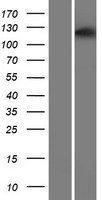 ASPP1 (PPP1R13B) Human Over-expression Lysate